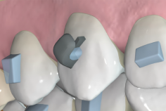 024 Integrated hooks