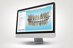 026 Ormco Digital Bonding