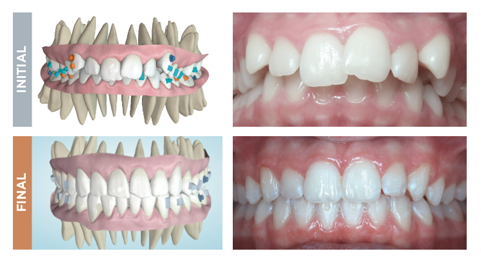029 Predicatble results 2.1